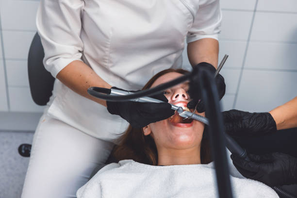 Best Emergency Tooth Extraction in Burlingame, CA