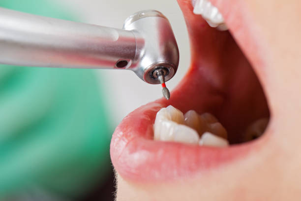Best Pediatric Emergency Dentist in Burlingame, CA